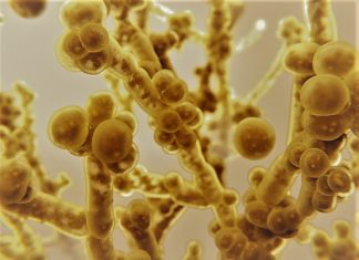 Deadly Candida Auris Invasion: How Hospitals Battle the Stealthy Fungus Threatening Lives
